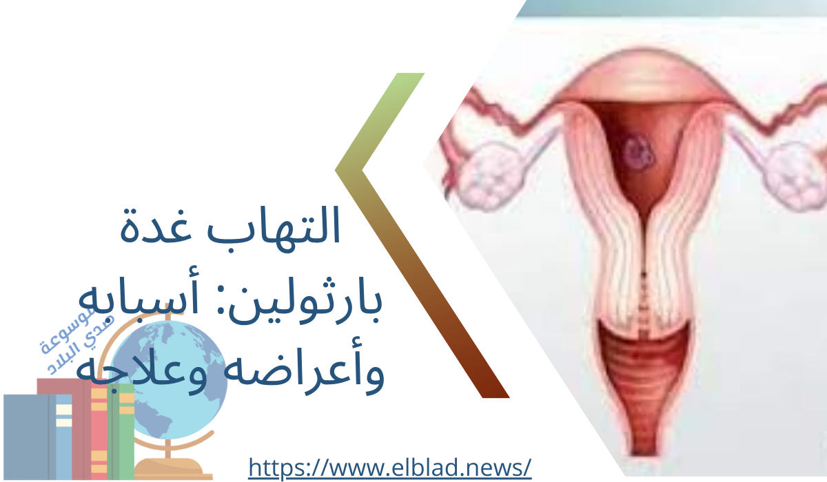 التهاب غدة بارثولين: أسبابه وأعراضه وعلاجه