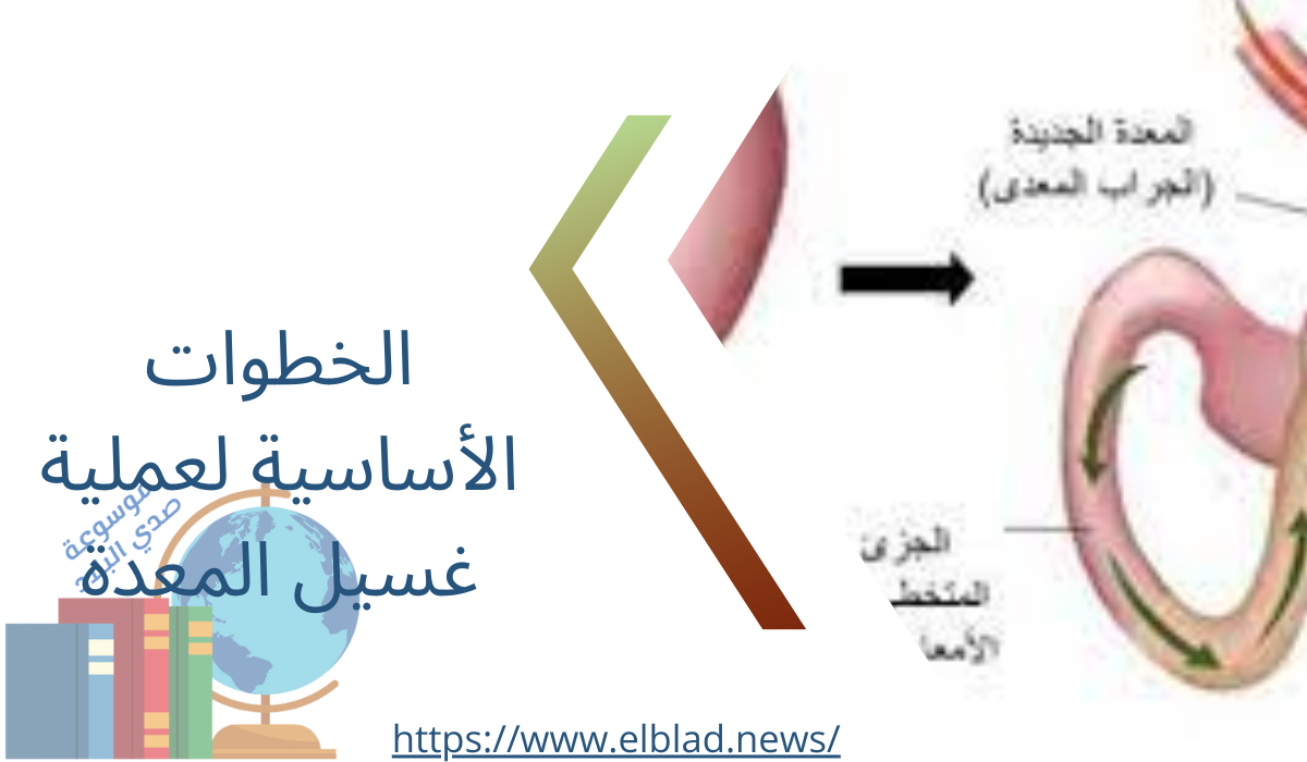 الخطوات الأساسية لعملية غسيل المعدة