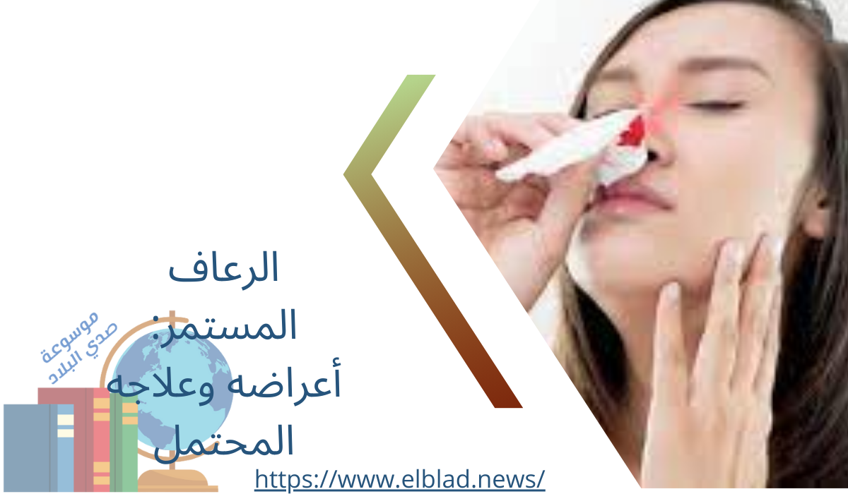 الرعاف المستمر: أعراضه وعلاجه المحتمل