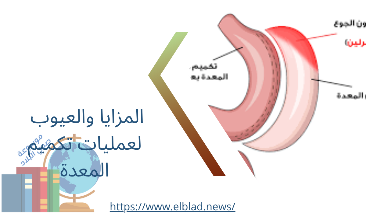 المزايا والعيوب لعمليات تكميم المعدة