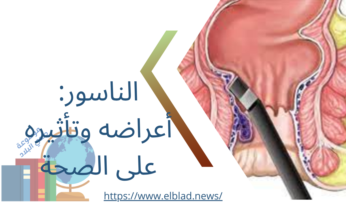 الناسور: أعراضه وتأثيره على الصحة