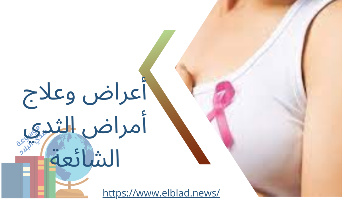 أعراض وعلاج أمراض الثدي الشائعة