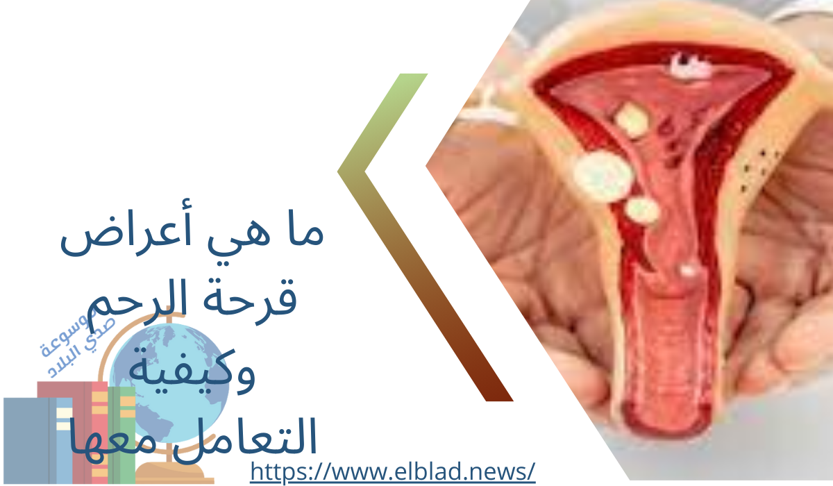 ما هي أعراض قرحة الرحم وكيفية التعامل معها