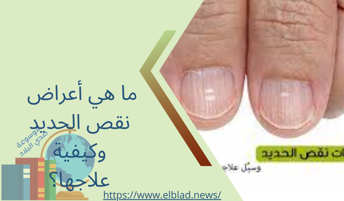 ما هي أعراض نقص الحديد وكيفية علاجها؟