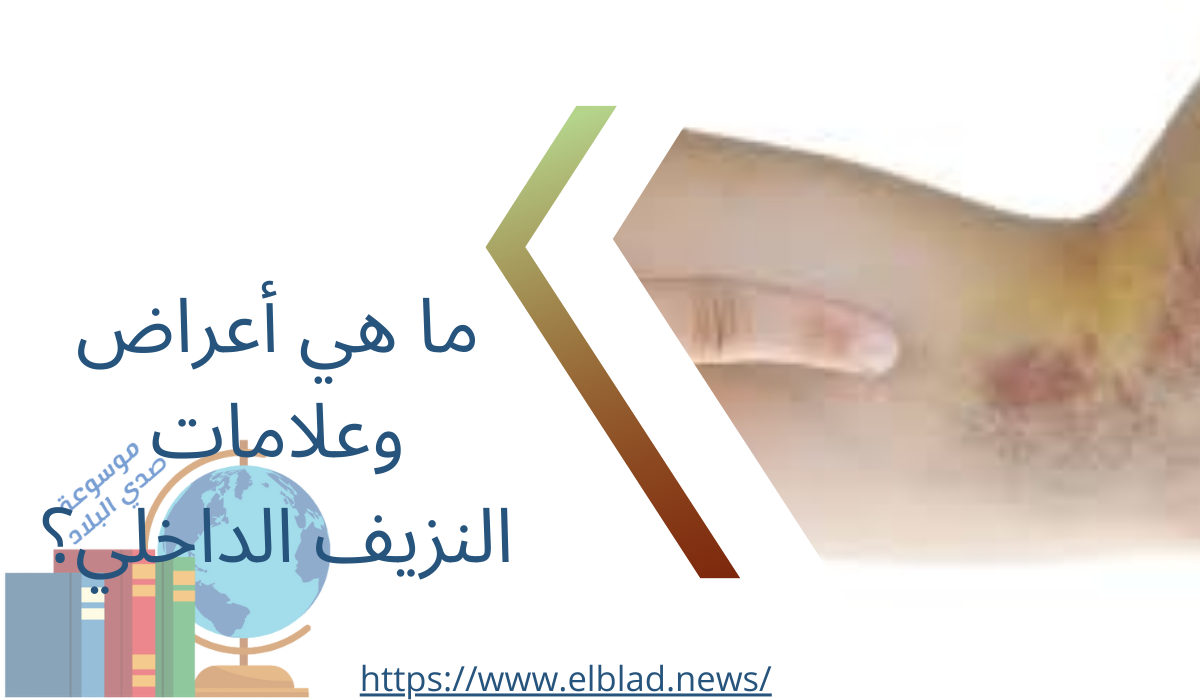 ما هي أعراض وعلامات النزيف الداخلي؟