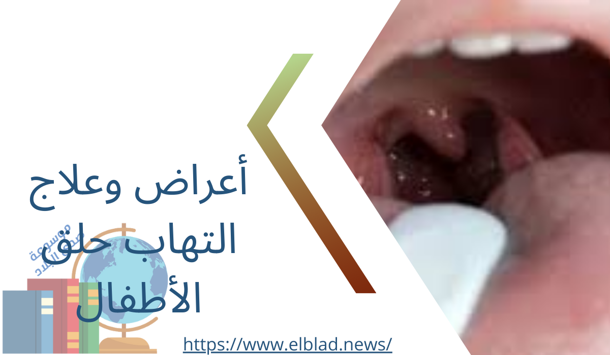 أعراض وعلاج التهاب حلق الأطفال