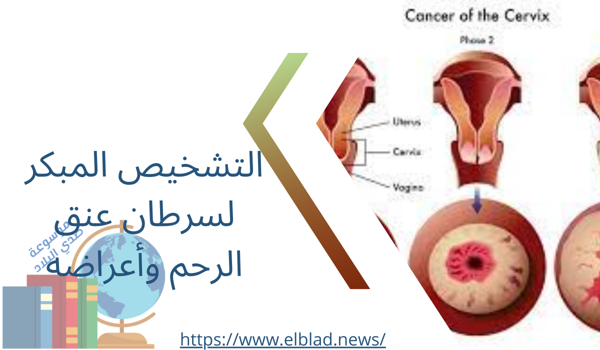 التشخيص المبكر لسرطان عنق الرحم وأعراضه