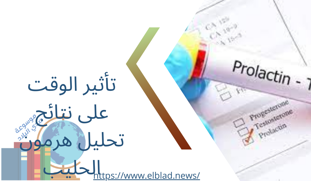 تأثير الوقت على نتائج تحليل هرمون الحليب