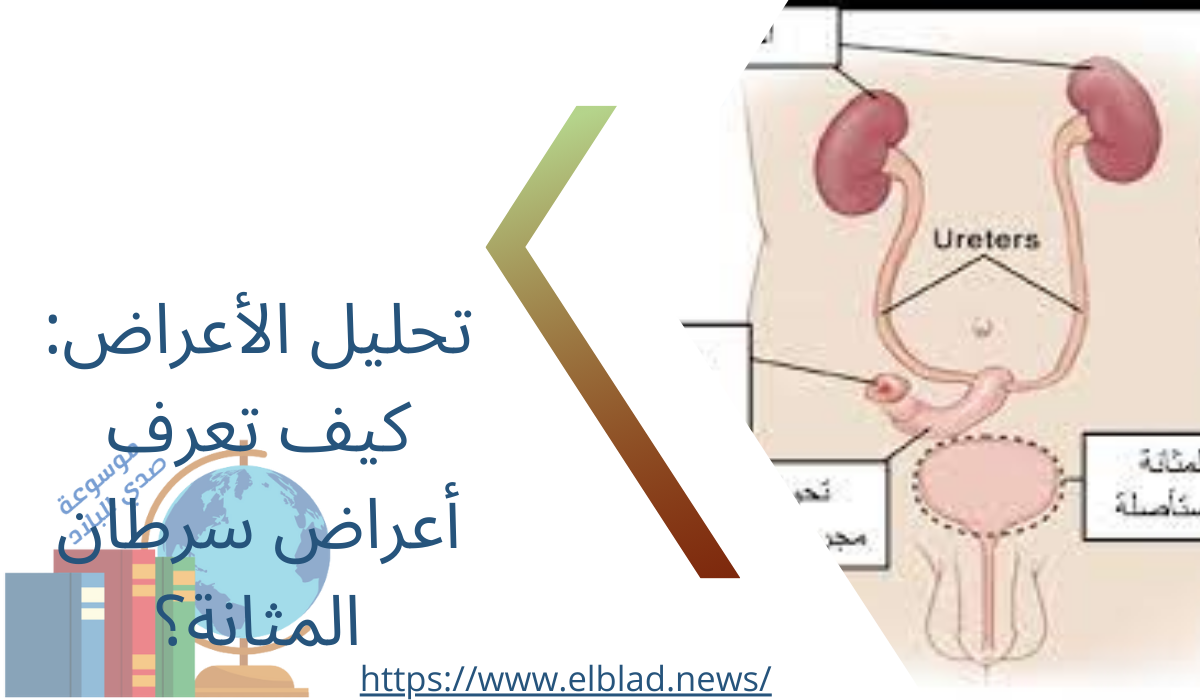 تحليل الأعراض: كيف تعرف أعراض سرطان المثانة؟