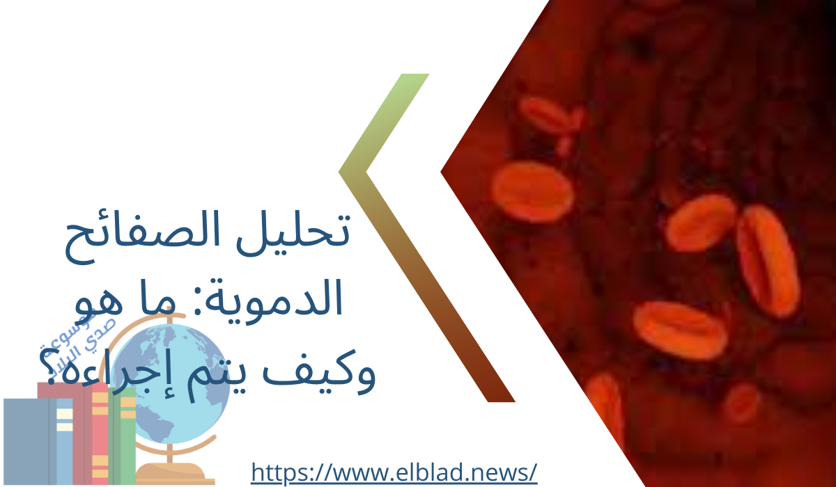 تحليل الصفائح الدموية: ما هو وكيف يتم إجراءه؟