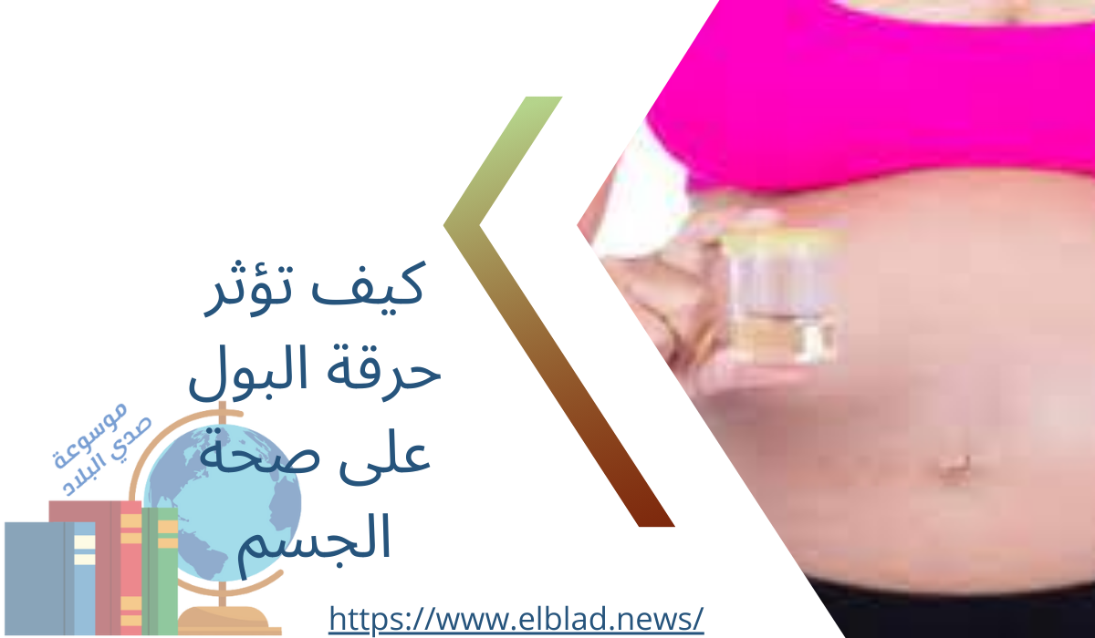 كيف تؤثر حرقة البول على صحة الجسم