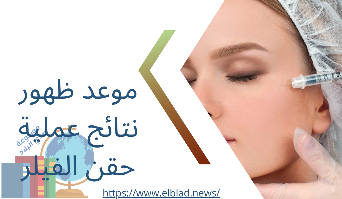 موعد ظهور نتائج عملية حقن الفيلر