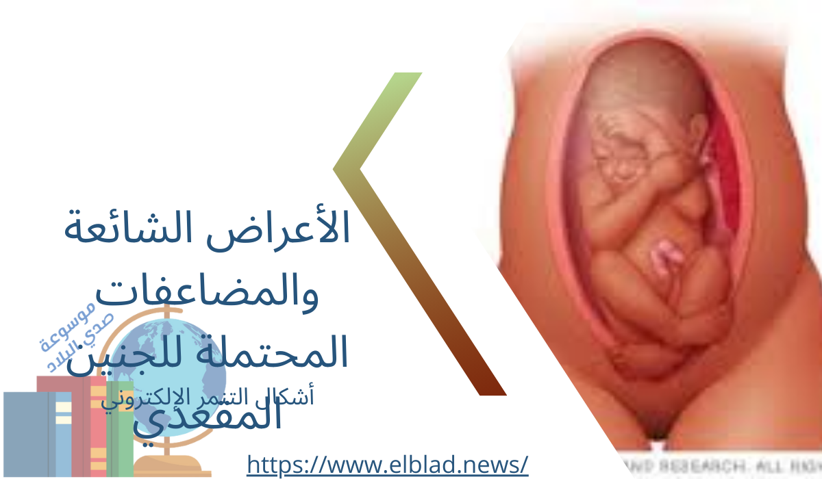 الأعراض الشائعة والمضاعفات المحتملة للجنين المقعدي