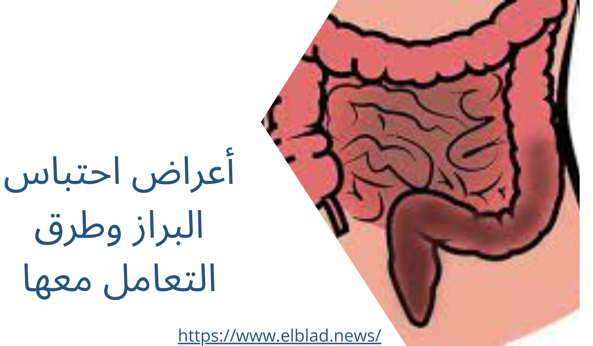 أعراض احتباس البراز وطرق التعامل معها