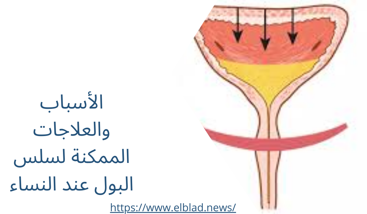 الأسباب والعلاجات الممكنة لسلس البول عند النساء