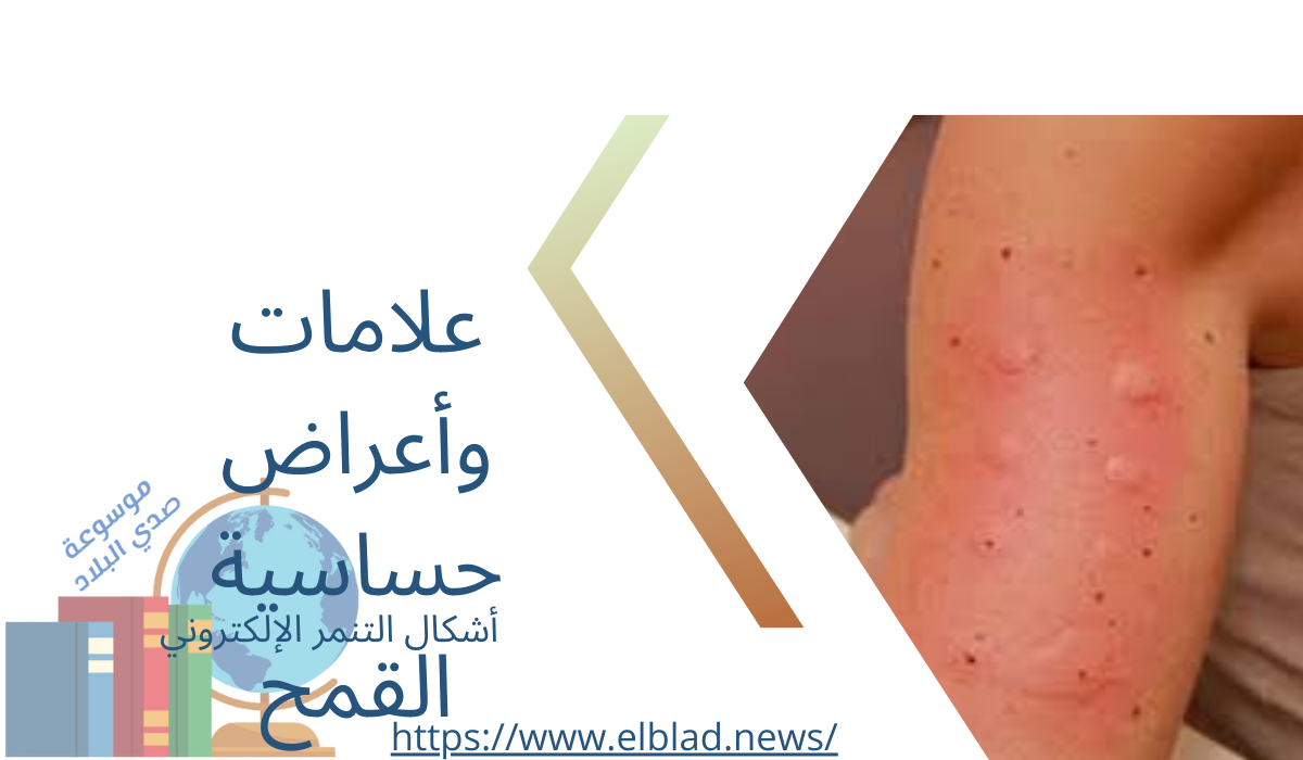 علامات وأعراض حساسية القمح