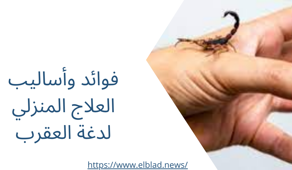 فوائد وأساليب العلاج المنزلي لدغة العقرب